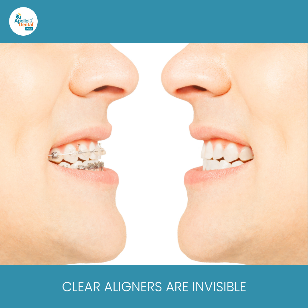 Invisalign Provider